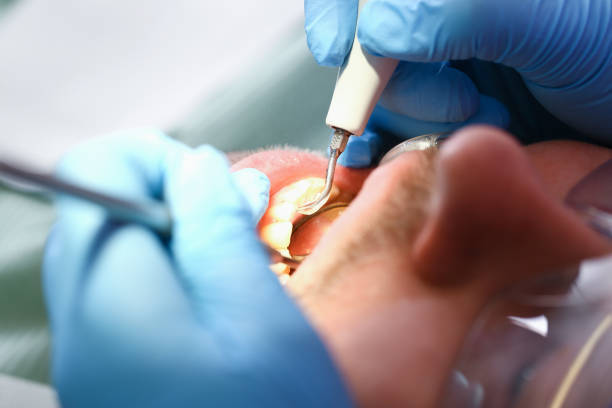 Best Pediatric Emergency Dentist in Des Peres, MO
