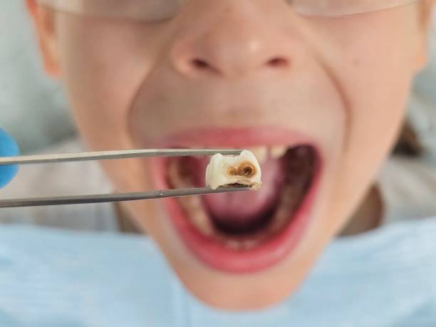 Best Emergency Treatment for Toothache in Des Peres, MO