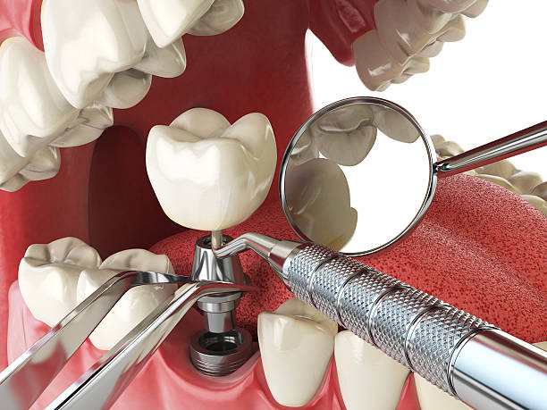Best Urgent Dental Care in Des Peres, MO